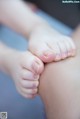 A close up of a person's feet with a bruise on their toes.